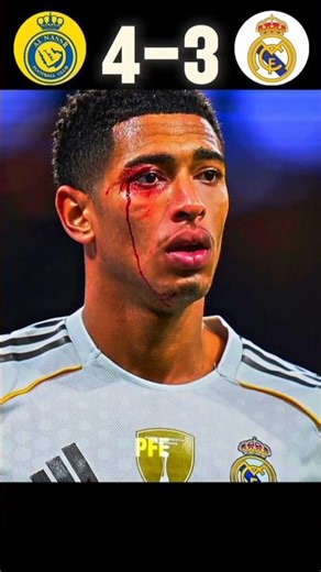 Ronaldo Returns to Al Nassr 🔥 | The King Is Back 👑