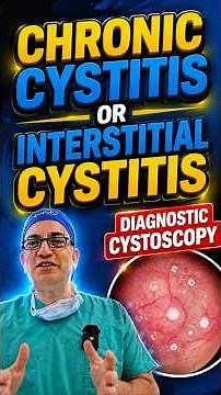 Chronic Cystitis vs Interstitial Cystitis Diagnostic Cystoscopy Explained by Dr. Cüneyd Sevinç