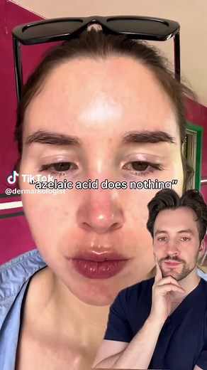The BEST azelaic acids of 2026 that you can get without a prescription Azelaic acid is THE underrated ingredient in skincare because it can help with so many different things! Not every azelaic acid product is going to be the same though, so here is how to choose the best one based on your skin concern Original vid: @Natalie O'Neill #azelaicacid #skincaretips #dermarkologist #glowingskin