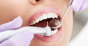 Tooth Filling: Cost, Materials, Types and Procedures - Dentaly.org