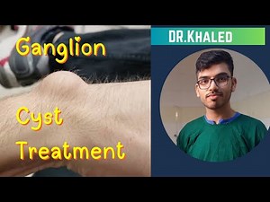 Ganglion Cyst Aspiration & Steroid Injection