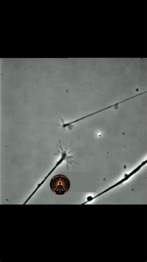 This Is How Neurons Form New Connections 🧠⚡ (Neuroplasticity Explained)