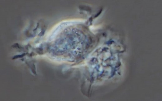 显微镜下的树突状细胞爬啊爬