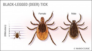 Mayo Clinic expert speaks of significance of Lyme disease uptick - Mayo Clinic News Network