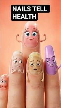 Different Types of Nails You Should Know