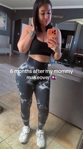 Mommy Makeover Journey: 6 Months Transformation