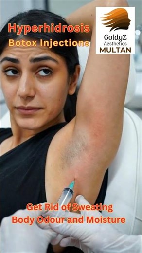 Hyperhidrosis | Botox Injection in #Multan