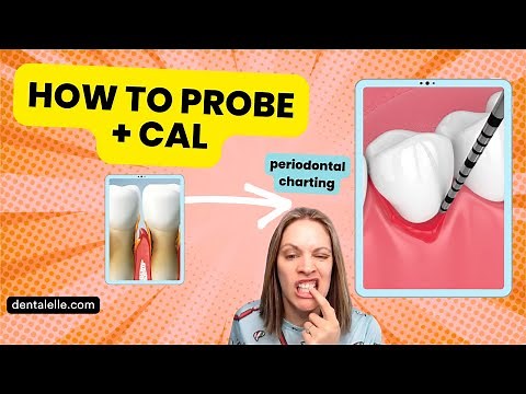 Are You Doing It Wrong? Detailed Perio Charting and Cal + Recession + Inflammation