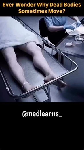 Medical Student on Instagram: "post-mortem leg movements like spasms or twitching don’t mean a person is returning to life; they are caused by residual electrical energy or nerve impulses in muscles after the brain stops, creating sudden contractions or involuntary movements, sometimes called the “final jerk,” but this is part of the body’s gradual shutdown, not a sign of life. Follow for @medlearns_ interesting videos #medstudent #daily #explore #know #nursing"