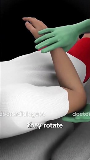 detailed 3D animation of shoulder dislocation