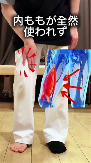 #足指ほぐし 足の親指の横…その角質。実は、“靴のせい”だけではないかもしれません。