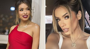 Shirley Arica se aplica por primera vez botox en el rostro: “Para prevenir las arrugas″[VIDEO]