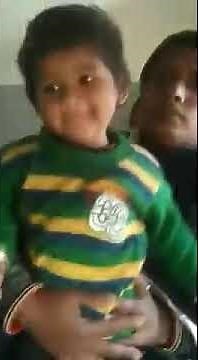 West syndrome- Benign infantile spasm. Contributed by Dr Surendra Godara