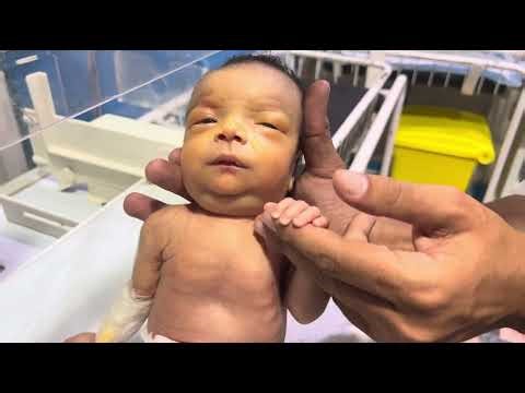NNJ Baby Care | How to Manage Neonatal Jaundice in Newborns