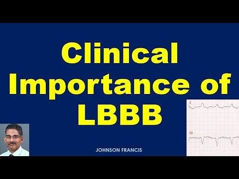 Clinical Importance of LBBB