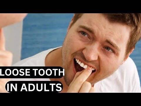 why your teeth feel LOOSE and what to DO about it