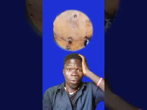 Jigger removal Deep cleaning part 2 #jigger #cleaning #clear #Asmr #infection #jiggers #clean