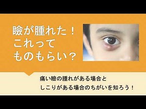ものもらいってどんな病気？