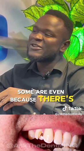 Causes of Toothaches Explained by Ibadan Dentist