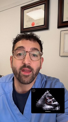 👉 What is a sigmoid septum? A sigmoid septum refers to a “S-shaped” curvature of the basal interventricular septum—often seen in older adults and linked to hypertensive remodeling and aortic stenosis. Echocardiography helps identify this subtle but important finding. | The Echo Journal