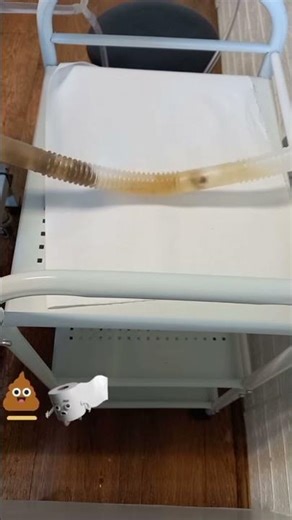 Sticky poo? Here's what it means