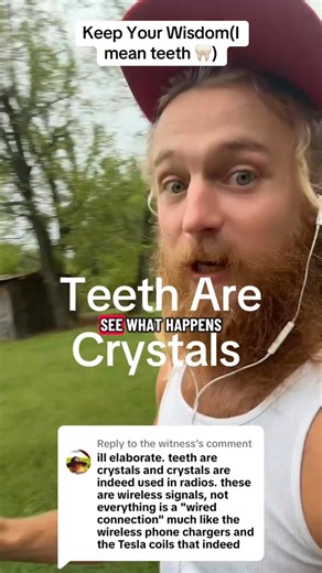 18K views · 358 reactions | Replying to @the witness Yes, teeth are...