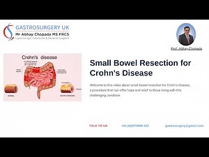 Small Bowel Resection for Crohn's Disease: A Patient's Guide | Dr. Abhay Chopada | Gastrosurgery UK