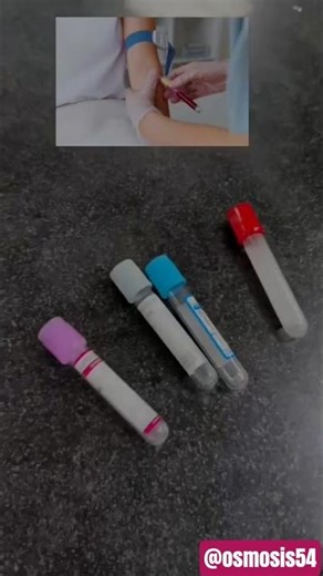 uses of different vials #medico #medicosstuff uses of vial in laboratory #laboratory #vialshorts