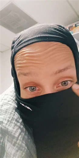 Understanding Heterochromia: What Is It?