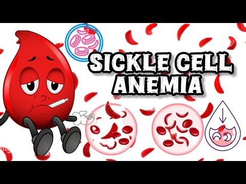 Sickle Cell Anemia||Pathology||BAMS||Mordern Disease||Causes||Symptoms||Pathogenesis||