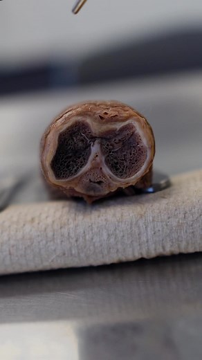 Understanding the Anatomy of the Human Penis