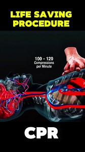 117.CPR LIFE SAVING PROCEDURE #Cardiopulmonaryresuscitation #CPRheroes #SaveLivesWithCPR #CPRawareness #LearnCPR #CPRtraining #CPRskills #CPRsaves #BeACPRpro #CPRcertified #CPRisImportant | Surgery Page
