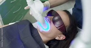Led teeth whitening. Ultraviolet rays. lamp for teeth enamel whitening. Beautiful smile. The health of teeth. Dentist stomatologist whitening teeth for patient in medicine dental clinic with lamp