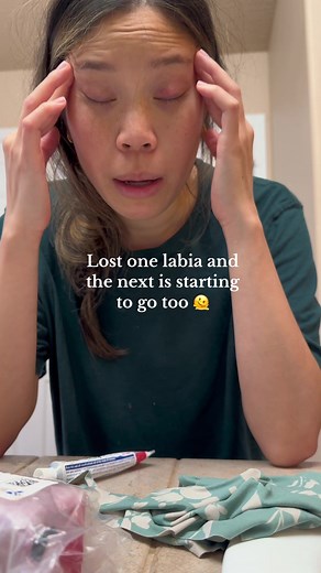 Lichen Sclerosus: Losing My Labia & Fighting for Relief