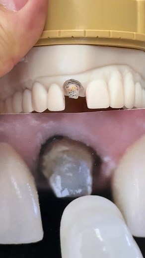 Masked! | Luke Kahng