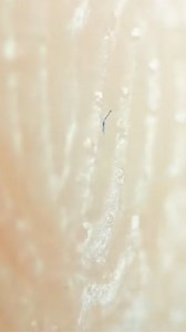 Human Fingers Under the Microscope – Should I Try Fish Fingers Next?