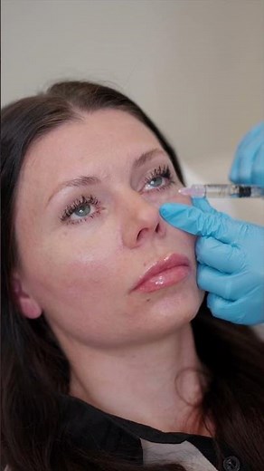 Rejuvenate Your Skin with Polynucleotides Injections | Este Medical