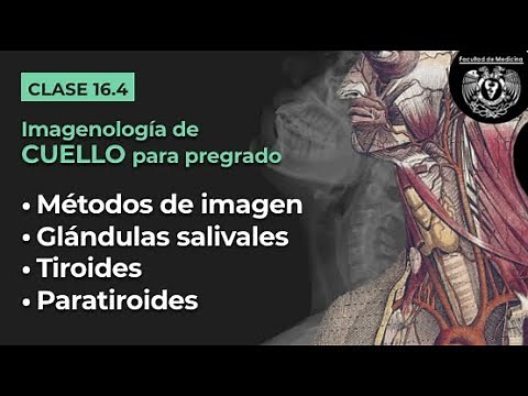 16.4 - Introducción a la imagen del cuello (glándulas salivales, tiroides y paratiroides)