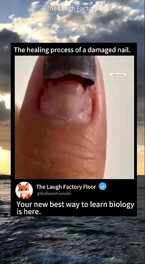 🪵This is how a damaged 💅 nail grows back over time 🧬 | MDCT