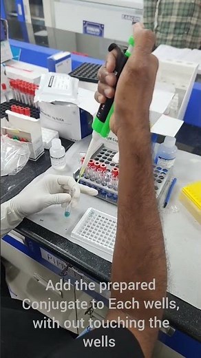 ELISA | DENGUE IgM | Step by step