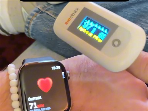 苹果手表的心率测量居然能这么准确！