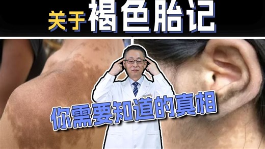 【皮肤科教授】这种胎记，如何处理？