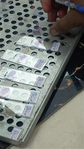 Slide labeling-Slides are label to ensure accurate tissue identification, prevent specimen mix-ups