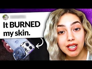 iPhone 15 Chaos Escalates, TikToker: "It literally BURNED me"