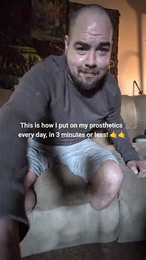 Amputee Morning Routine: Putting on Prosthetics