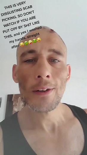 Satisfying Scab Picking Compilation | Gross but Addictive Videos