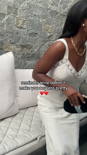 Embrace Your Beauty: Overcoming Acne with Positivity