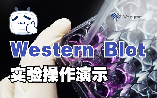 Western Blot（蛋白质印迹法，WB）实验操作演示