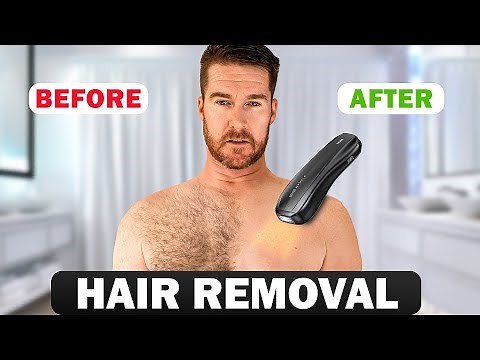 At Home Laser Hair Removal That Works? | ULike X IPL Device Full Review & Results
