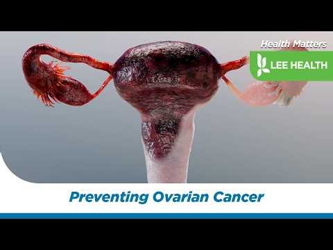 Preventing Ovarian Cancer